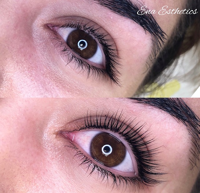 eyelash lift