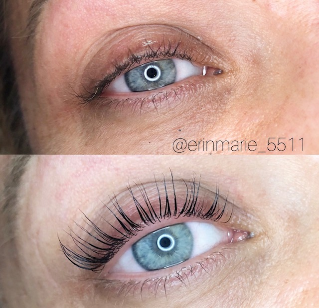 eyelash lift